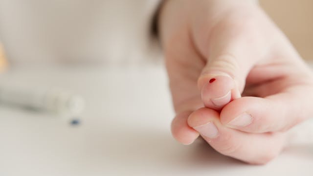 Finger prick blood test to check blood glucose levels