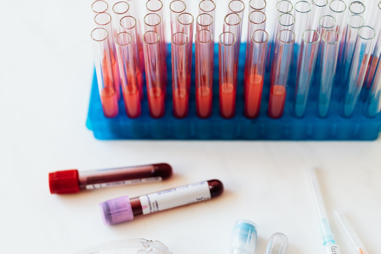 Test tubes with blood samples