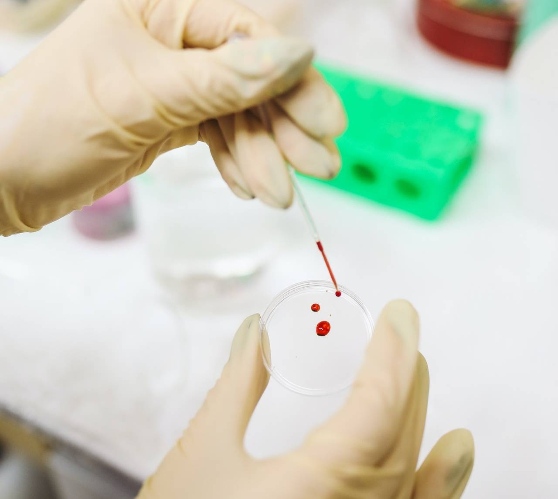 Scientist dropping blood into dish for titer test